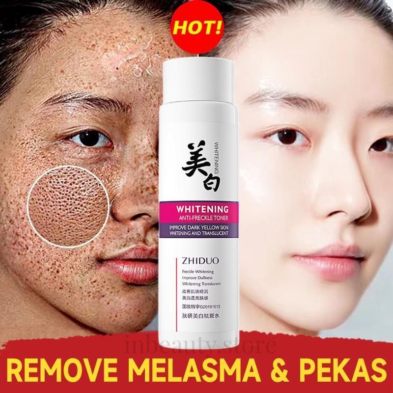 Melasma Cream Remove Dark Spot Nicotinamide Whitening Freckle Cream ...