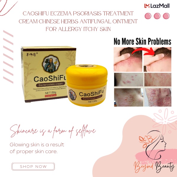 ☏☃CAOSHIFU Eczema Psoriasis Treatment Cream Chinese Herbs Antifungal