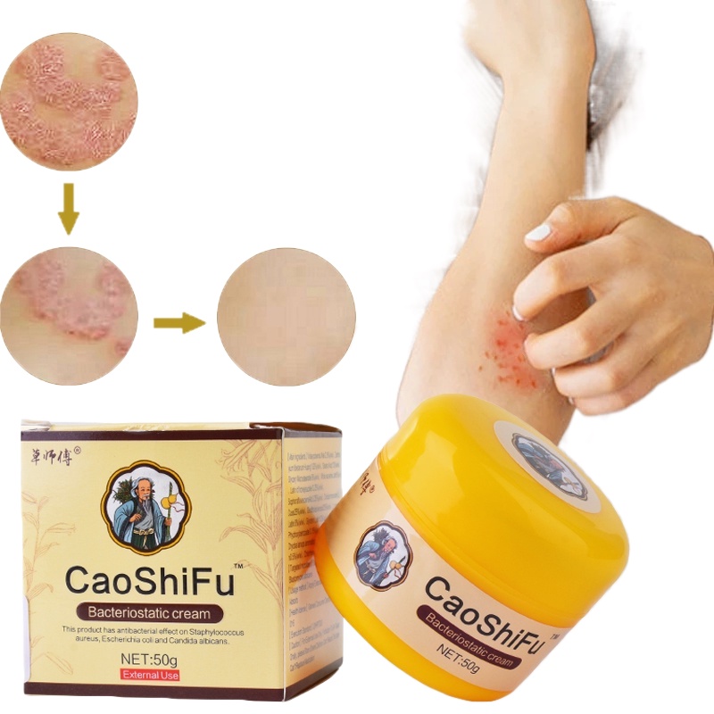 2023☃50g Caoshifu Eczema Psoriasis Treatment Cream Antifungal Ointment For Allergy Itchy Skin 