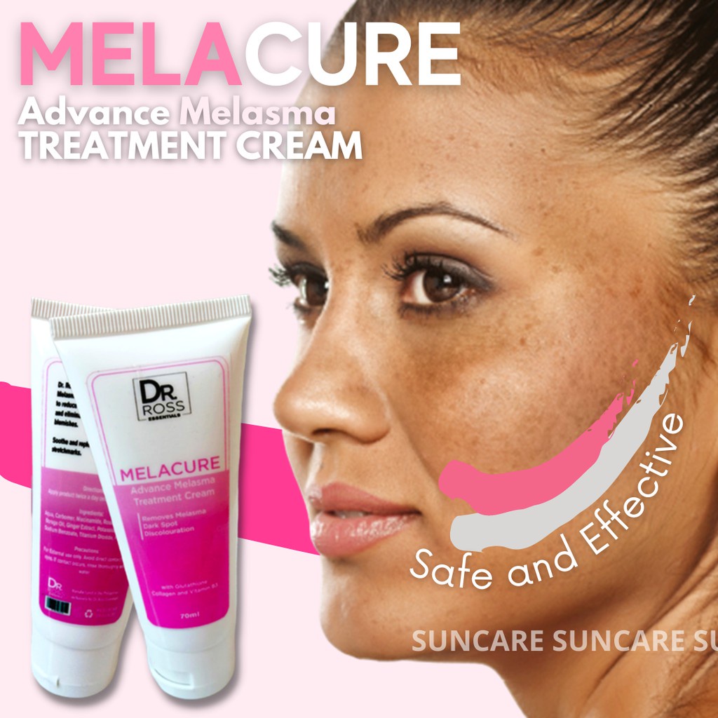 [SUNCARE] Melacure Advance Melasma Treatment Cream with VITAMIN B3 100 ...