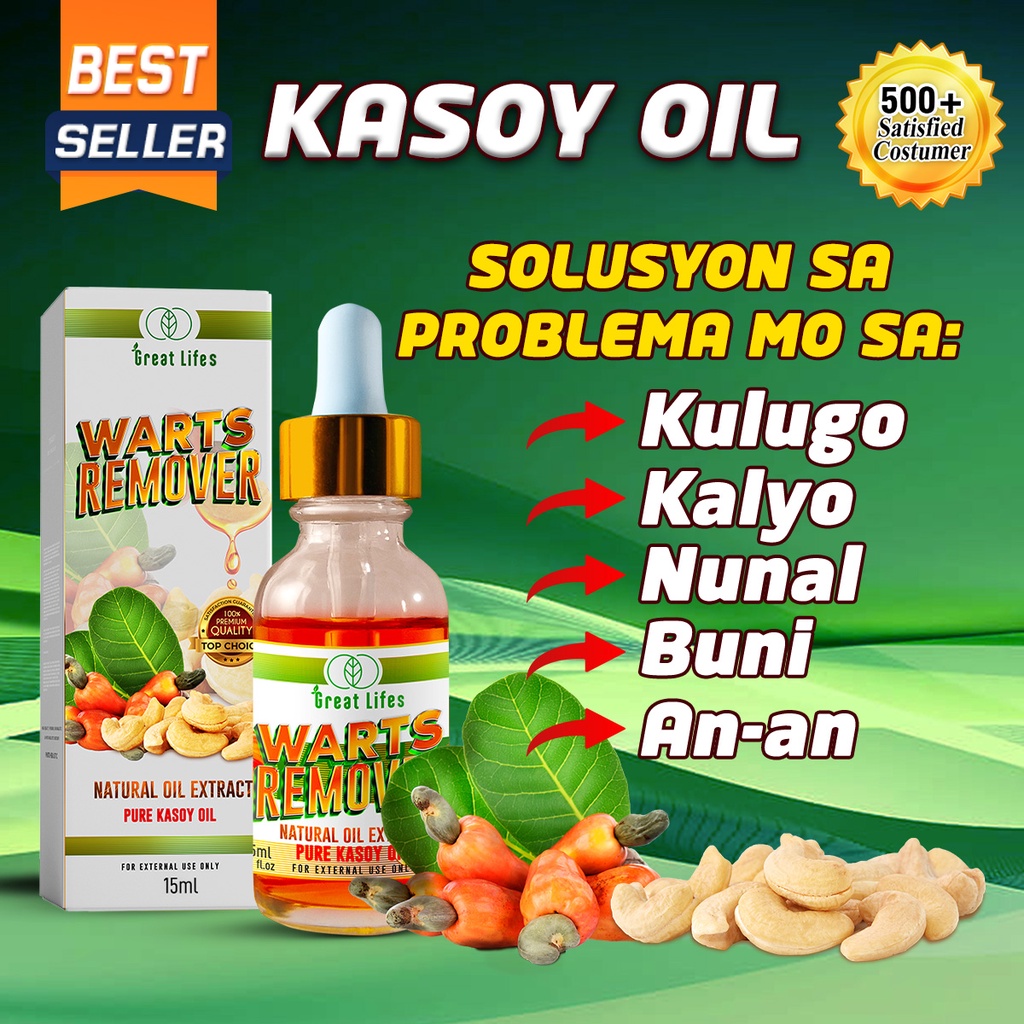 Warts Remover Ointment Kasoy Oil Tanggal Nunal, Kulugo, Kalyo, Kulugo ...