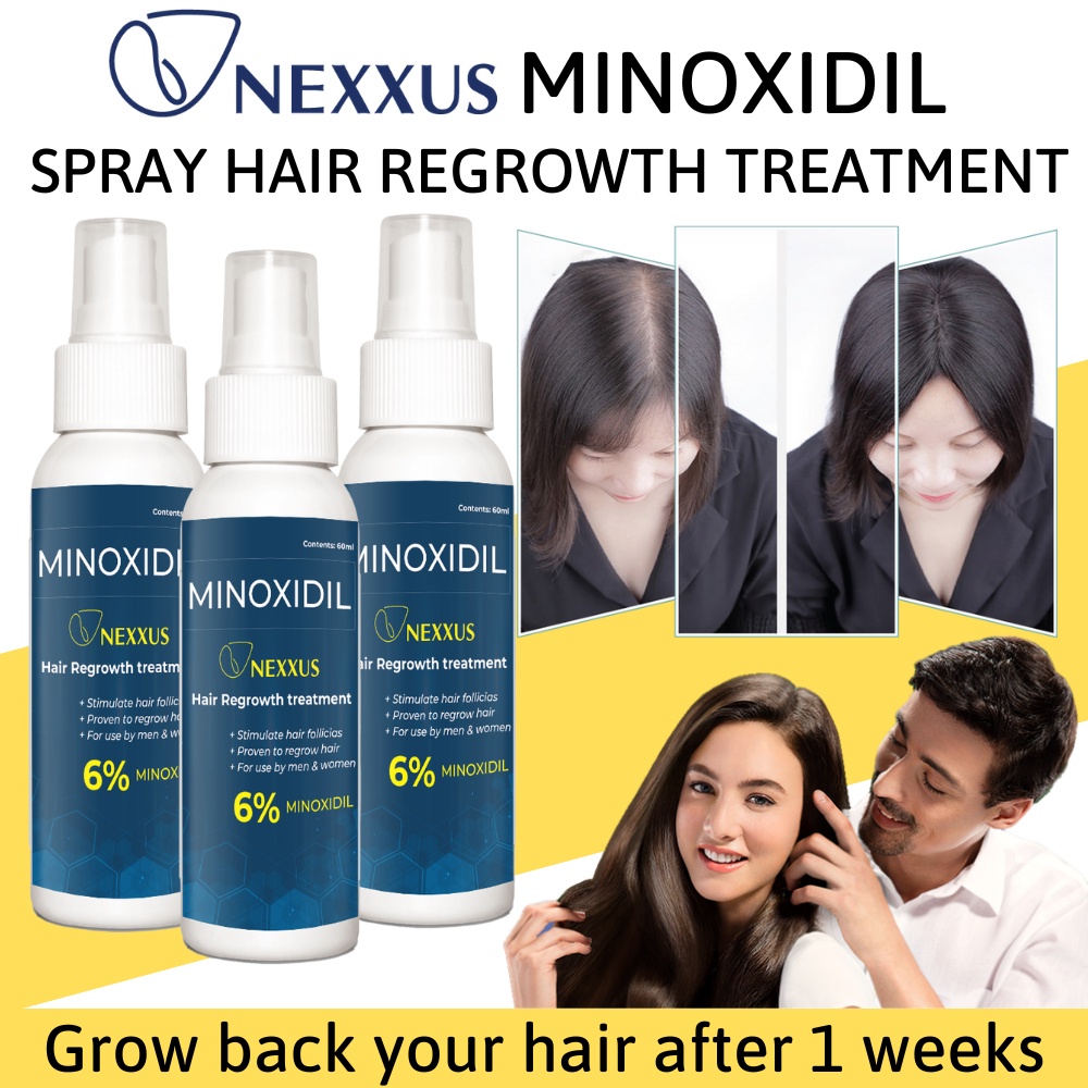 NEXXUS Minoxidil Spray Hair Regrowth Treatment Minoxidil Strands 6% ...