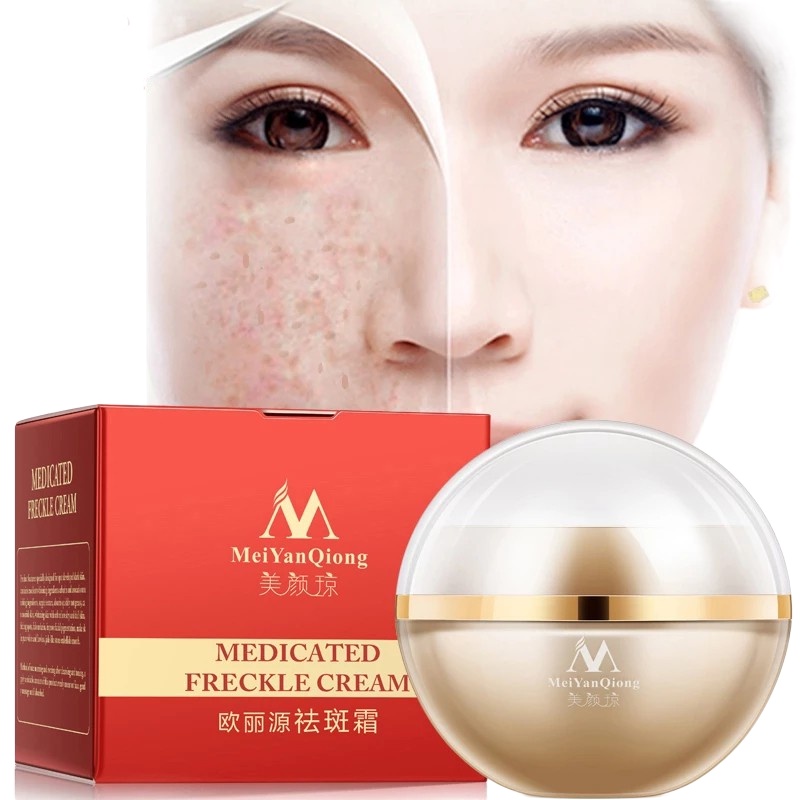 NEW MeiYanQiong Anti-Freckle Cream Brightens Skin Reduces The Spots ...