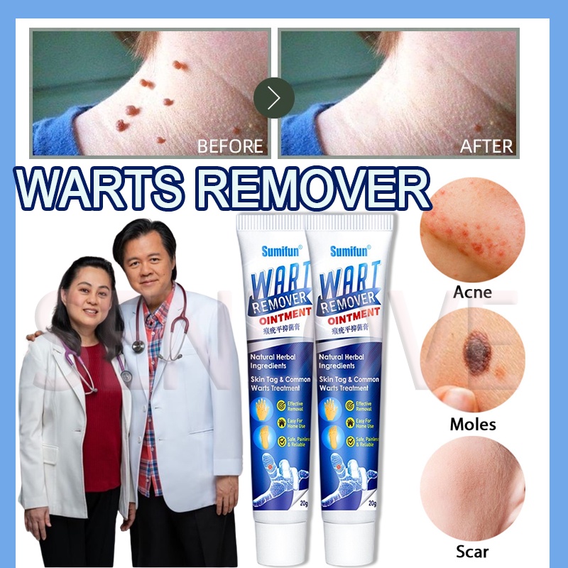 SENLOVE Effective Warts Remover Cream Warts Removal Foot Corns Kulugo