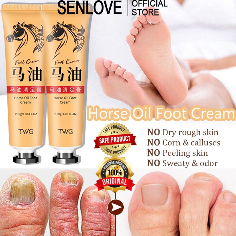 30g Horse Oil Callus Remover Foot Care Cream For Cracks And Dry Cracked