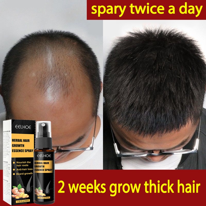 Eelhoe Hair Growth Serum Spray Original Fast Grower Treatment Anti Hair Loss Hair For Men And 4856