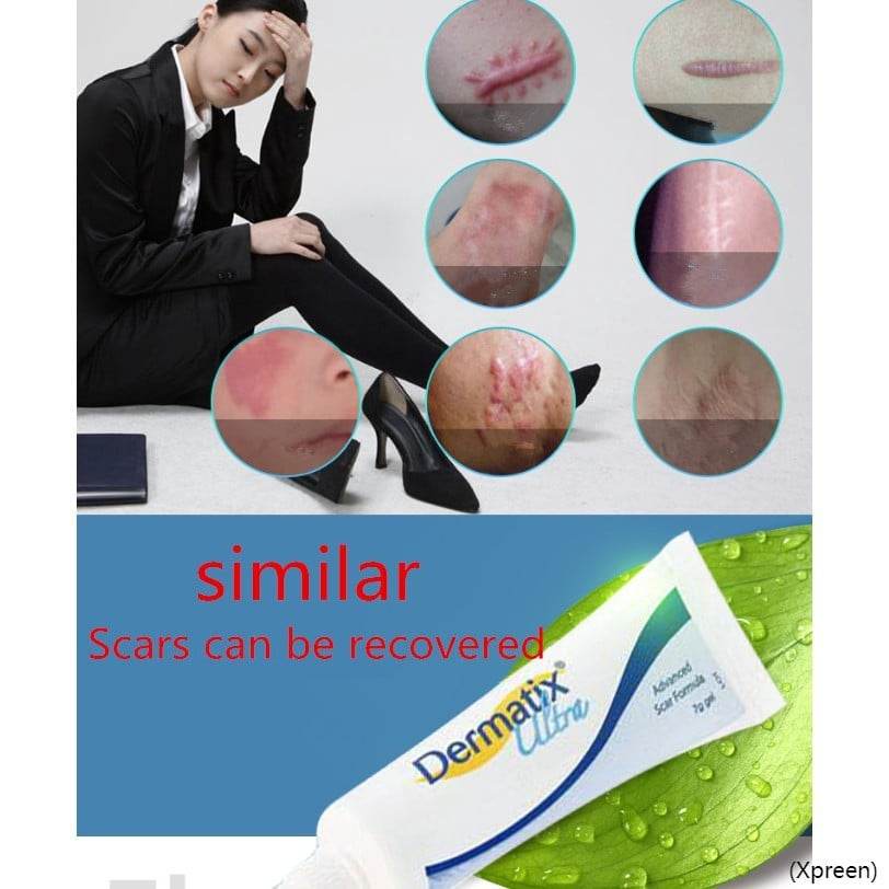 Scar Removal Cream Original Dermatix Effective Scar Gel Old Scars Acne