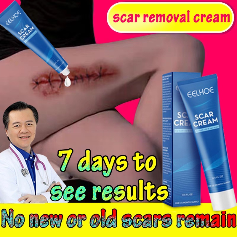 ∏scar gel by doc willie ong fix scar removal original keloid scar ...