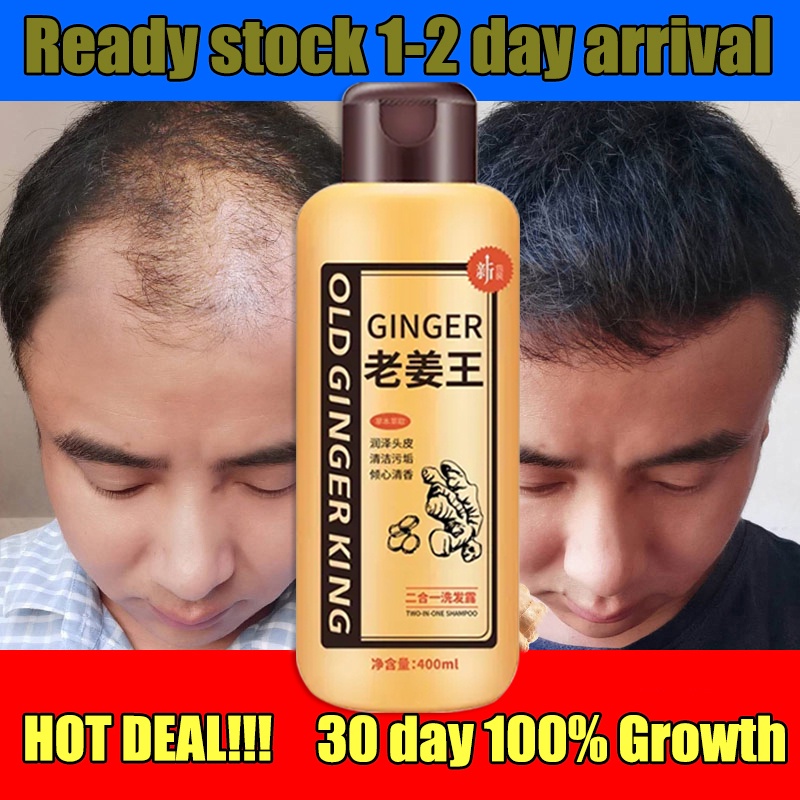 400ml Ginger Shampoo Anti Dandruff Shampoo Hair Scalp Treatment Anti