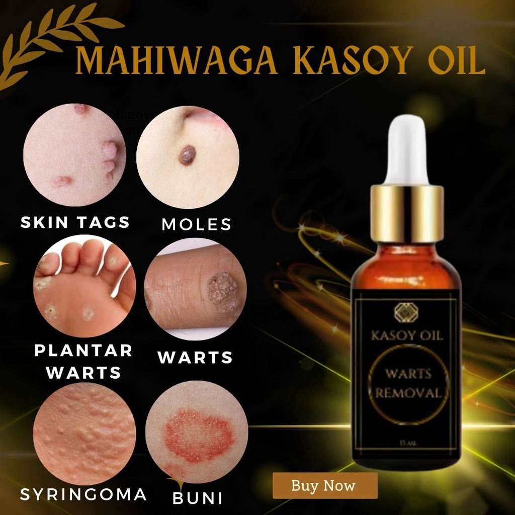 Shop wart remover for Sale on Shopee Philippines