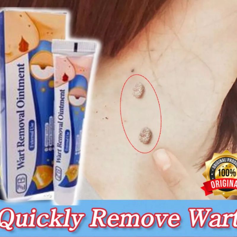 WART REMOVER OINTMENT REPAIR SAFELY WARTS TREATMENTS REMOVES SKIN TAGS