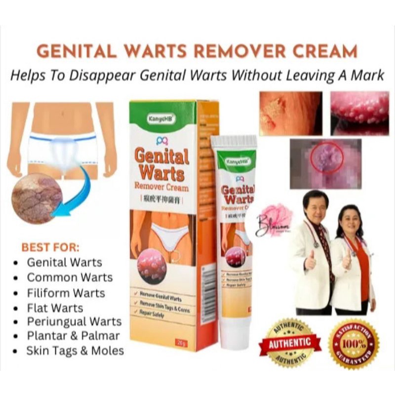 Genital Warts Remover Original Cream Condyloma Ointment Herpes Health