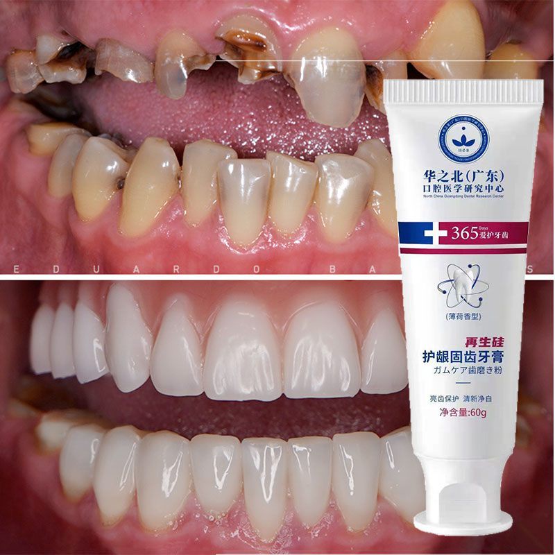 Teeth Whitening Yellowing Repair Toothpaste Quick Repair of Cavities ...
