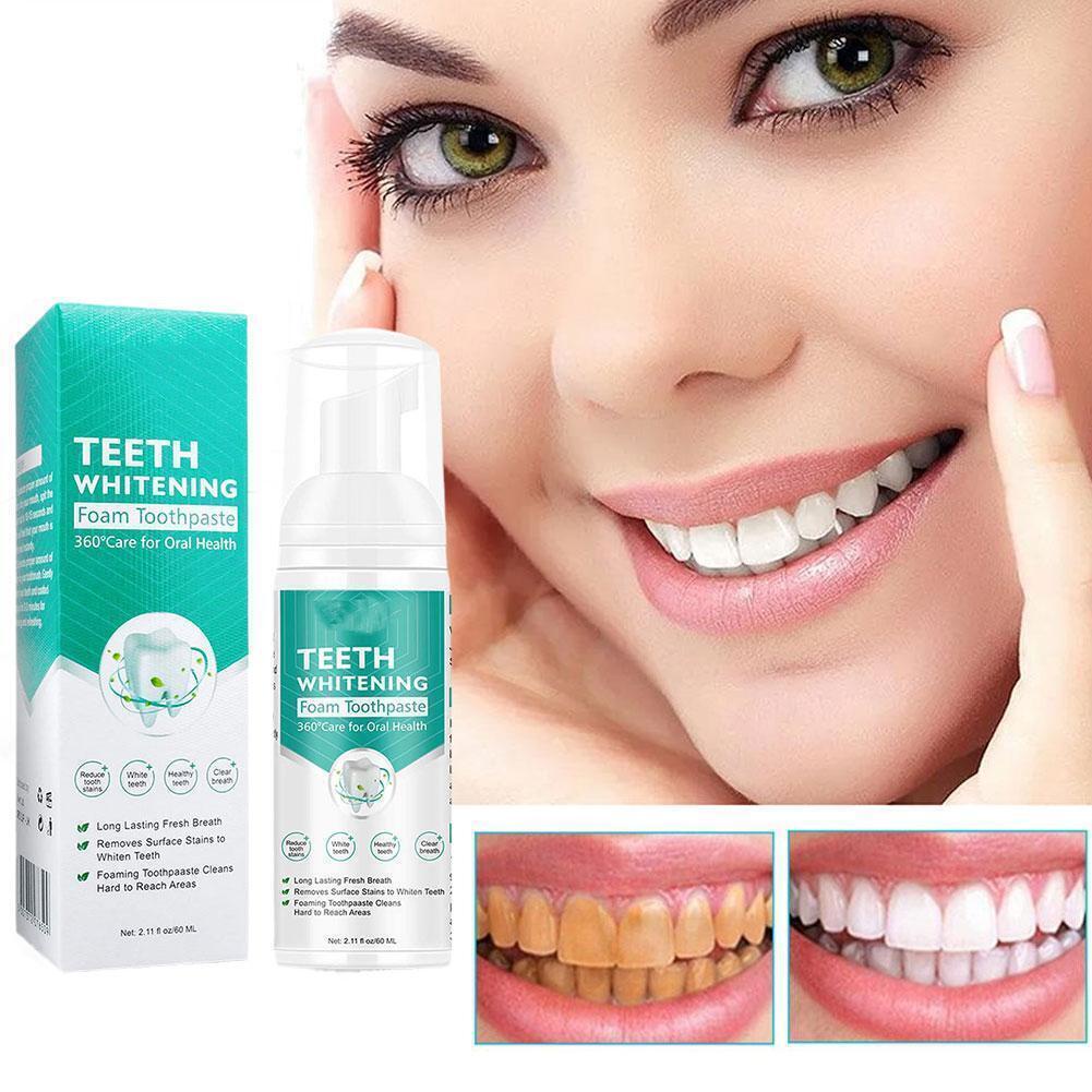 CB.PH Teeth Whitening Aliver Toothpaste Teeth Whitening Yellowing of ...