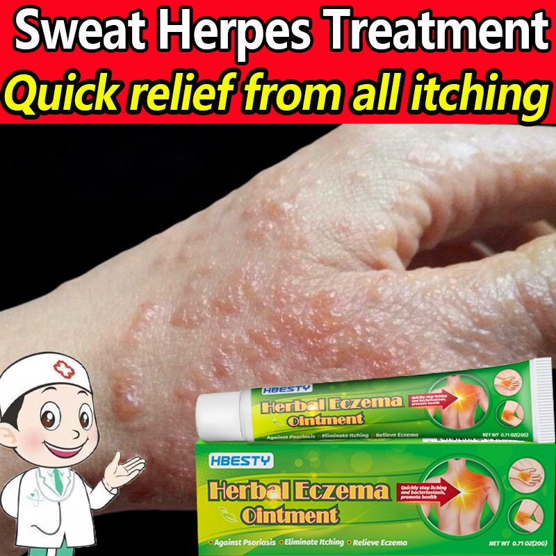 Eczema Cream for Itchy Skin Herbal Psoriasis Ointment Dermatitis Anti