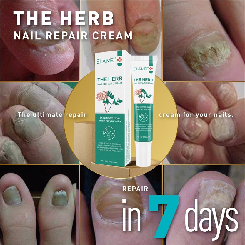 Nail fungus repair treatment Care Cream Essence Anti Fungal nail