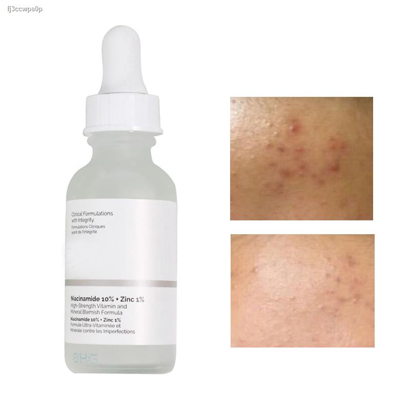 ☁AHA 30 + BHA 2 Peeling Solution Azelaic Acid/Niacinamide 10 + Zinc