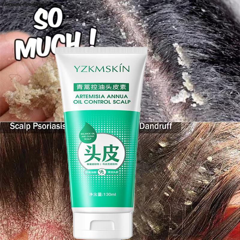 120ml Scalp Cleansing Shampoo Dandruff Seborrheic Follicles