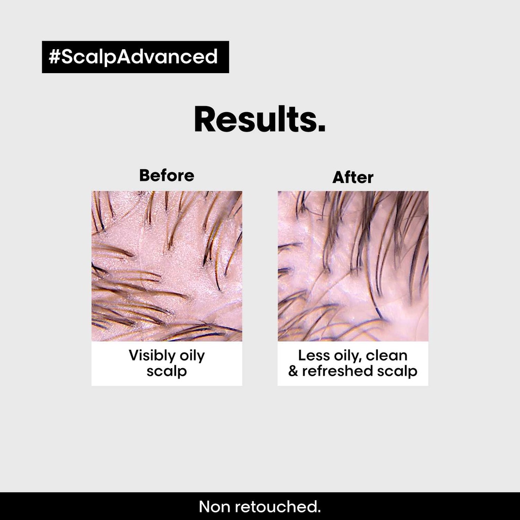 LOreal Professionnel Scalp Advanced Oily Scalp Clarifying Shampoo