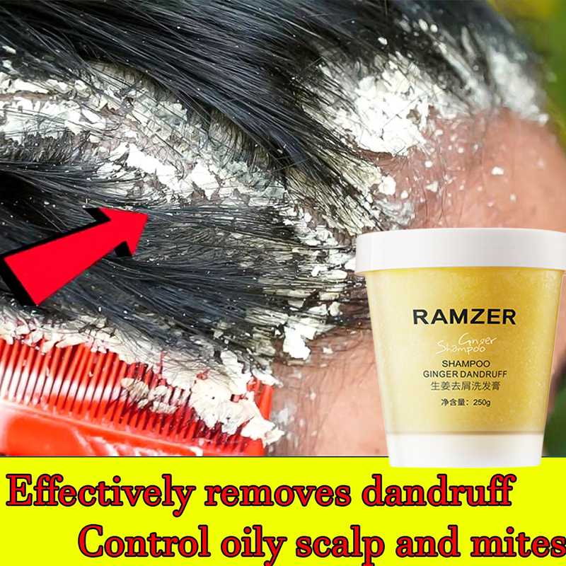 RAMZER Sea Salt Antidandruff Shampoo 250g Dandruff And Scalp Treatment
