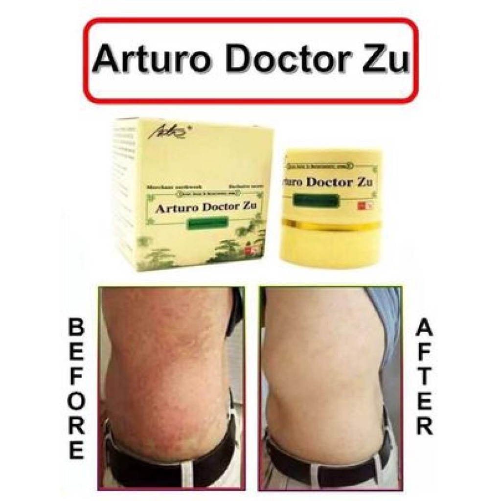 Original 100 Arturo Doctor Zu Skin Herbal Healing Ointment Anti