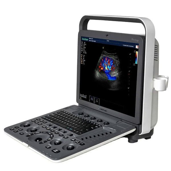 CE Approve Sonoscape S8Exp portable color doppler digital ultrasound ...