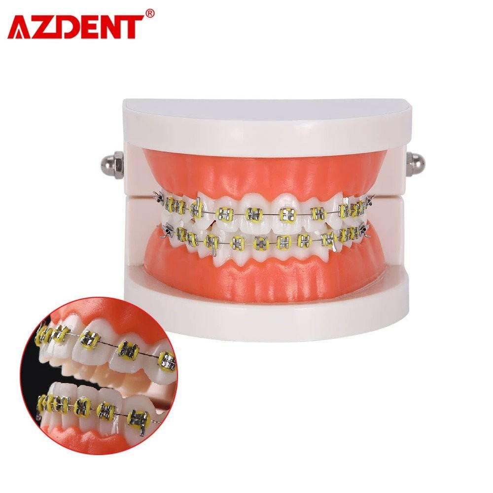 Dental Orthodontic Teeth Model Tooth Model with Metal Bracket Braces ...