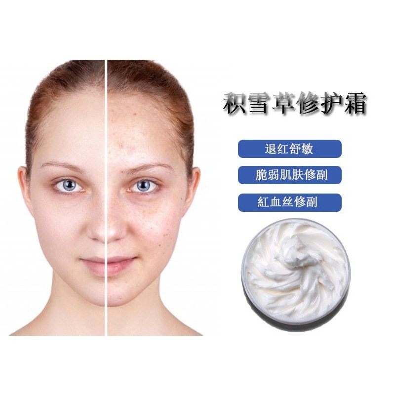 Red Face Skin Soothing Centella Asiatica Hormone Face Conditioning Hormone Face Damaged Acne
