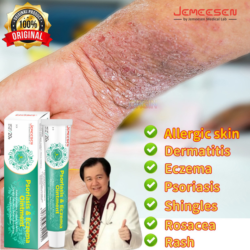 7 days psoriasis cream dermatitis eczematoid eczema Antibacterial ...