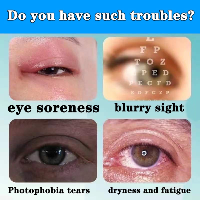 Blueberry Eye Drop Relieves Red Eyes Discomfort Blurred Vision Dry ...