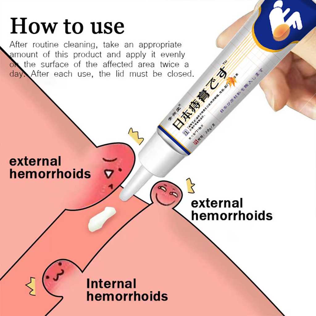 Hemorrhoids Miracle Ointment From Japan Original By Doc Willie Ong