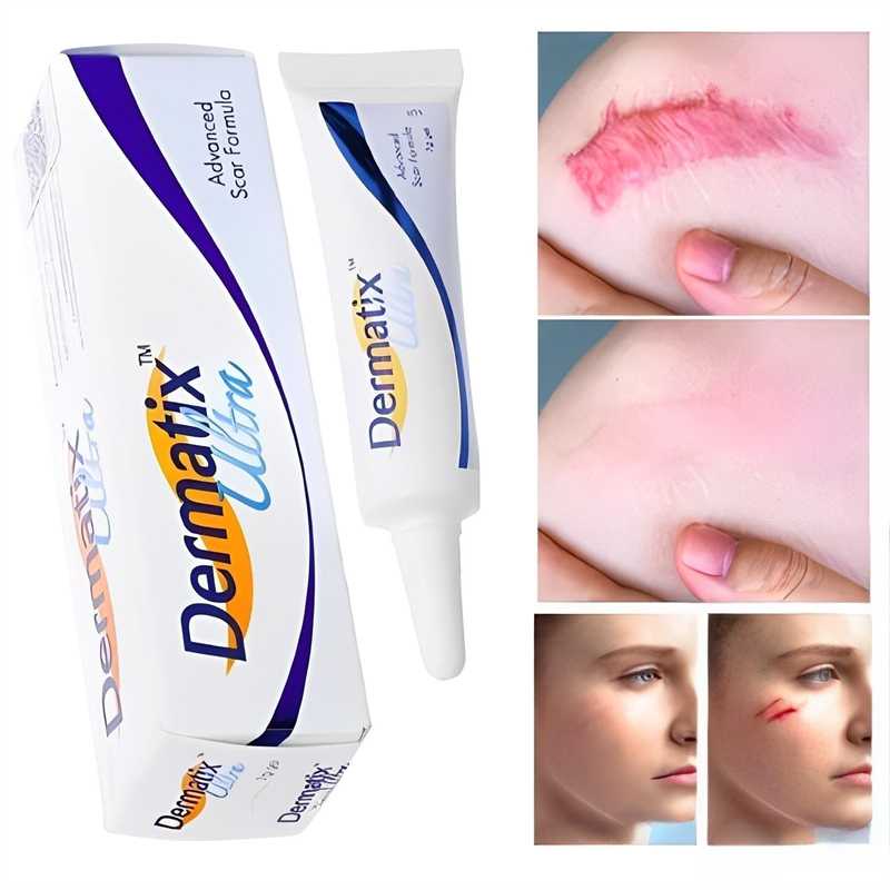 Original Dermatix Effective Scar Removal Cream Scar Gel Old Scars Acne