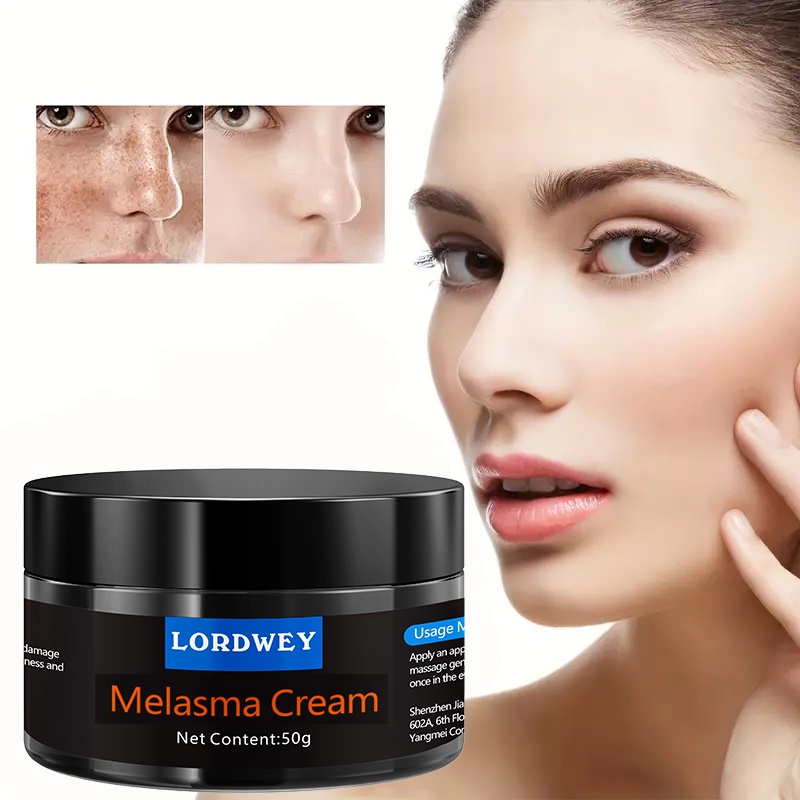 Original Melasma Cream Freckle Cream Whitening High Moisturizing Cream