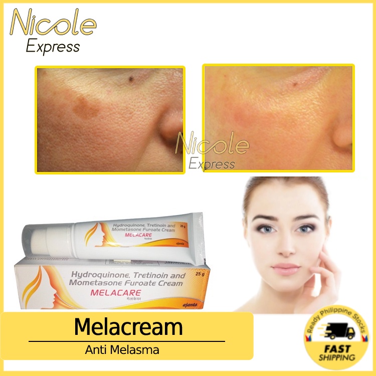 2024 Melacare Cream 25g for Melasma Pekas Remover Pekas Eraser Skin