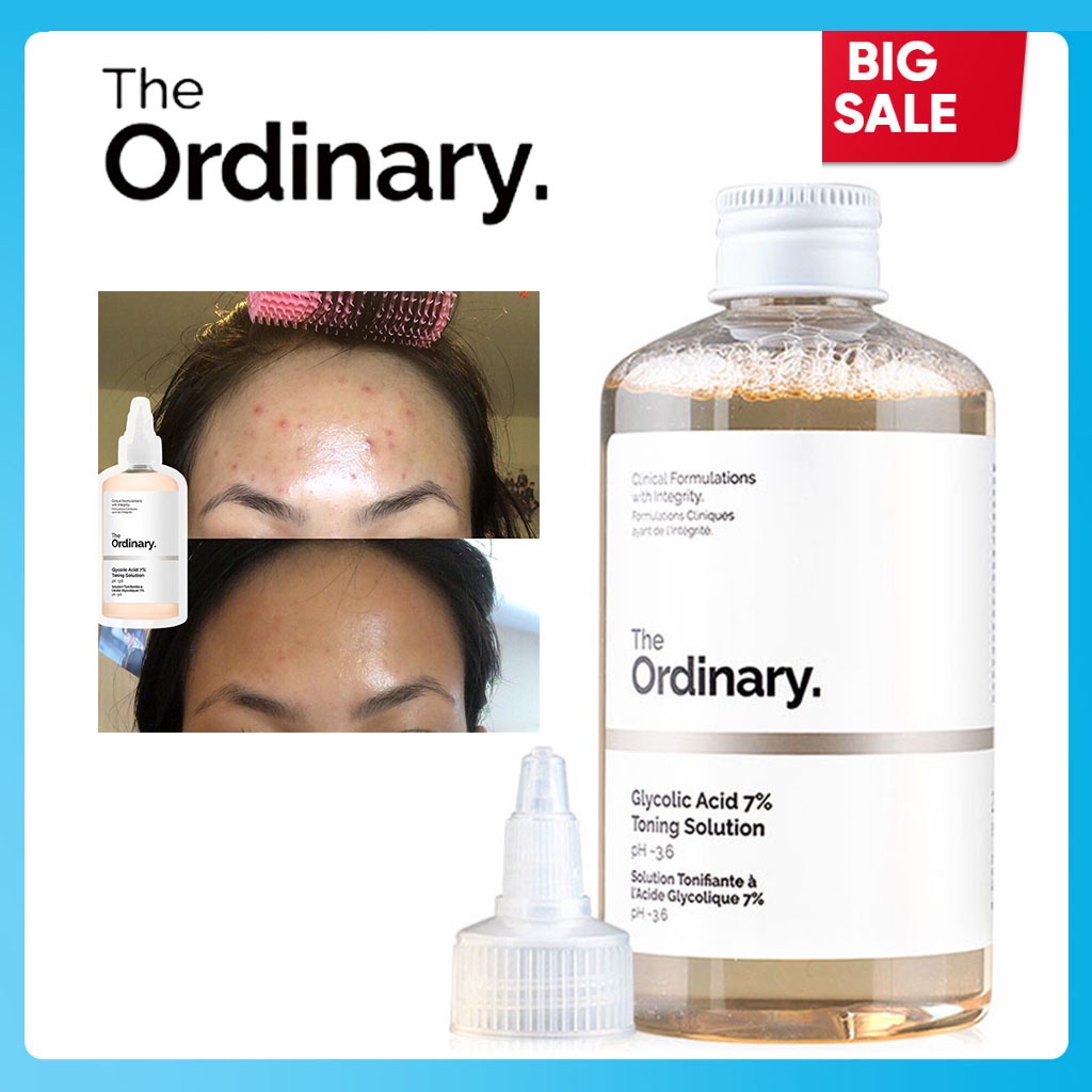 The Ordinary Glycolic Acid 7 Toning Solution Skincare serum 240ml