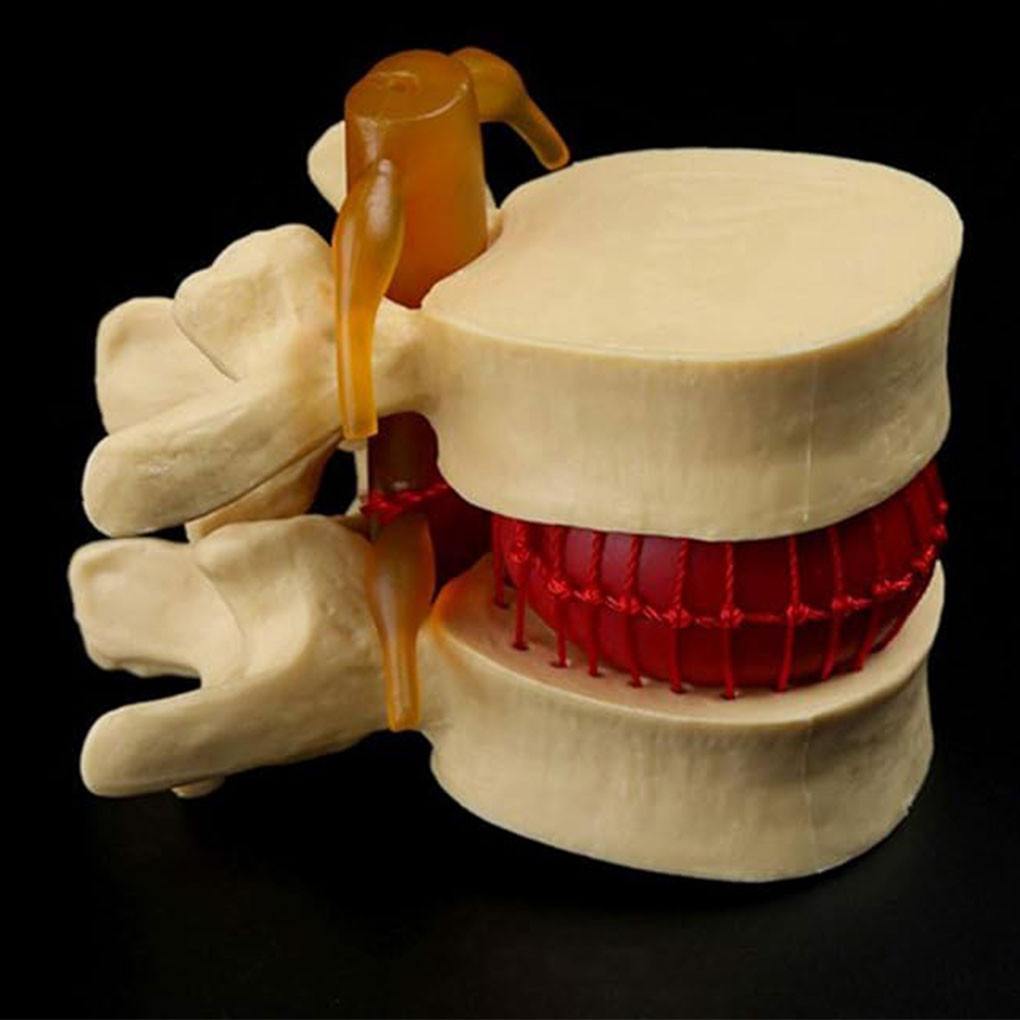 Anatomical Spine Lumbar Disc Model Flexible And Compact For Accurate ...