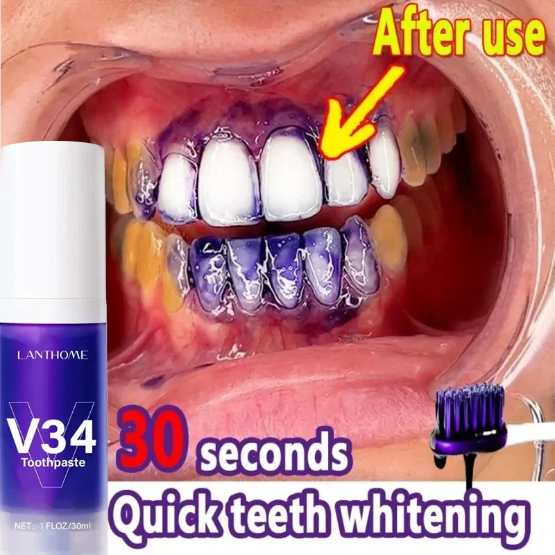 V34 Teeth Whitening Mousse Toothpaste Tooth Care Serum Gel Remove ...