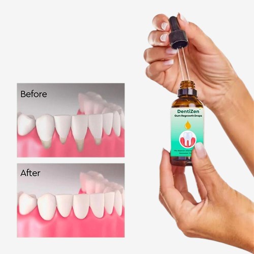 COD.toothpaste №Gum Disease Treatment Dentizen Gum Regrowth Drops