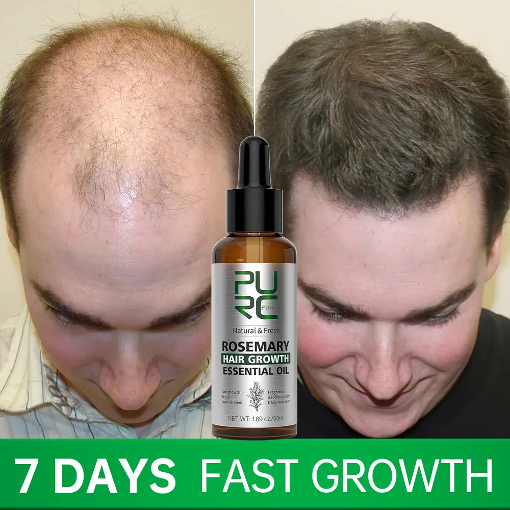 PURC Rosemary Oil Hair Growth for Men Women Fast Growing Products