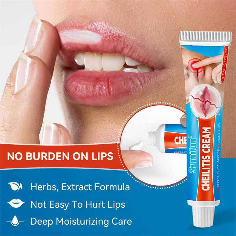 Sumifun 1Pc Cold Sores Lip Cheilitis Treatments Cream Herpes