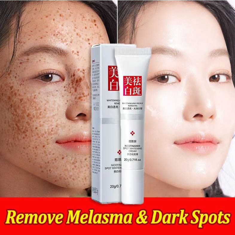 Effective Melasma Removal Cream Original Dark Spot Removal Cream Dr