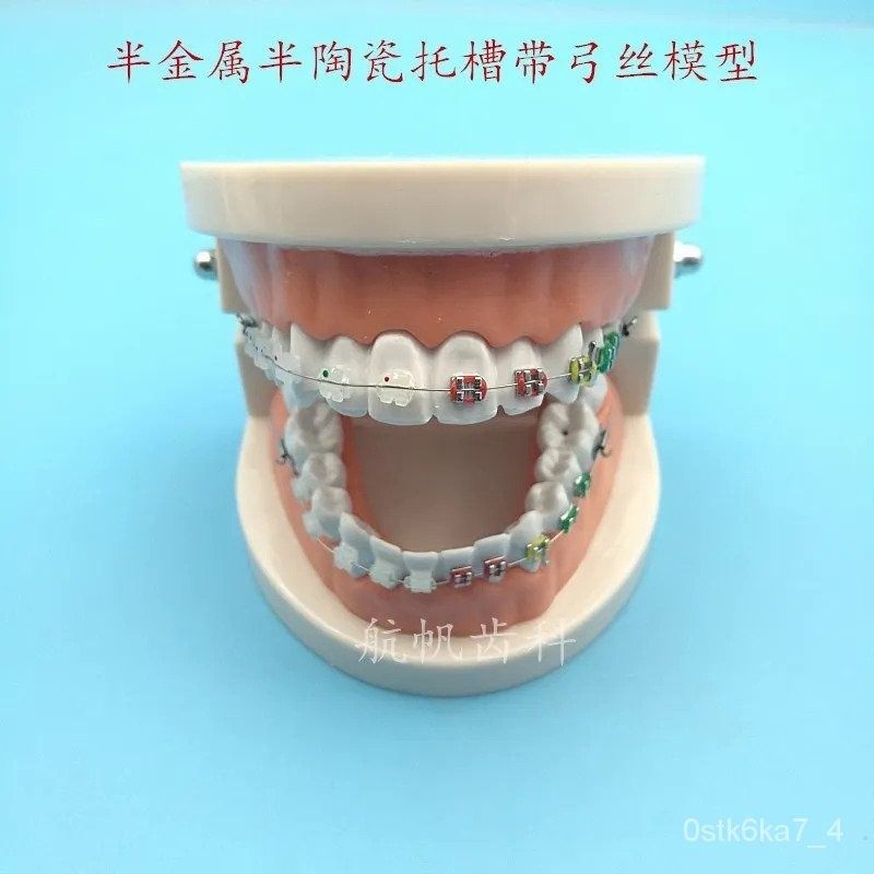 Dental Orthodontic Treatment Model Typodont With Ortho Metal Ceramic ...