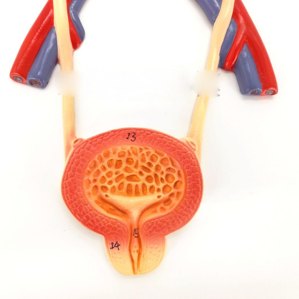 Anatomy Teaching Model Medical Bladder Liver Kidney Wall Plaque Urinary ...