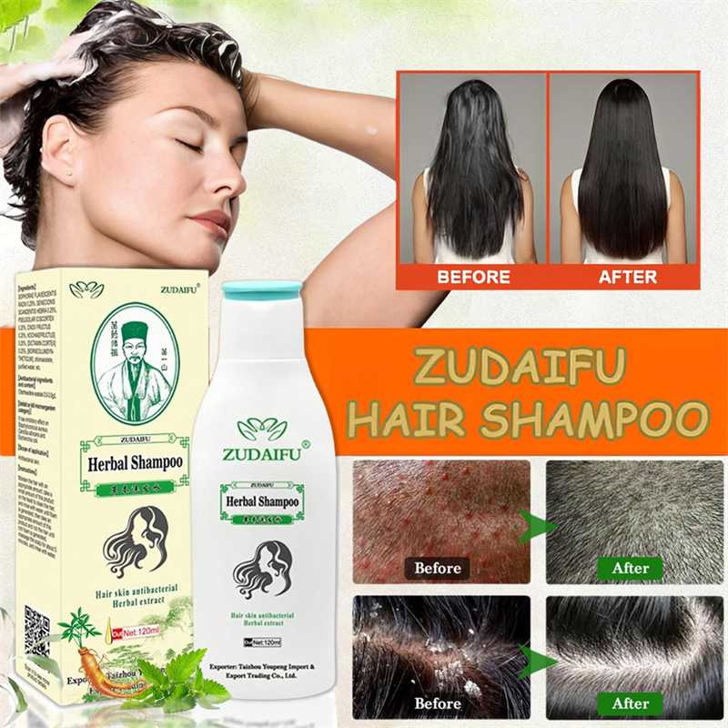 Zudaifu Herbal Shampoo 120ML Treatment Eczema Dermatitis Anti fungal