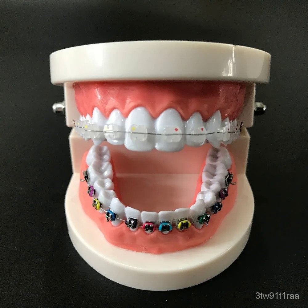 Dental Orthodontic Treatment Model Typodont With Ortho Metal Ceramic ...