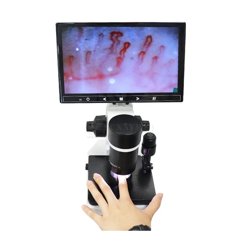 SYB198 Good Price Biological Capillary Microscope Video Capillaroscope