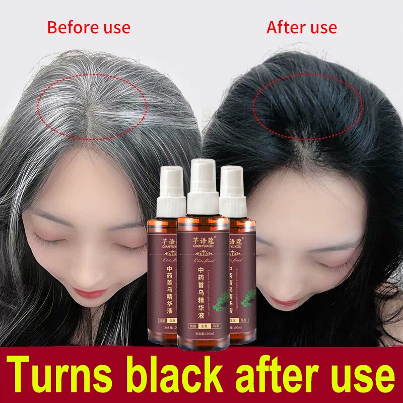 Black Hair Serum Dyeing Spray Black Hair Growth Shampoo 100ml Polygonum