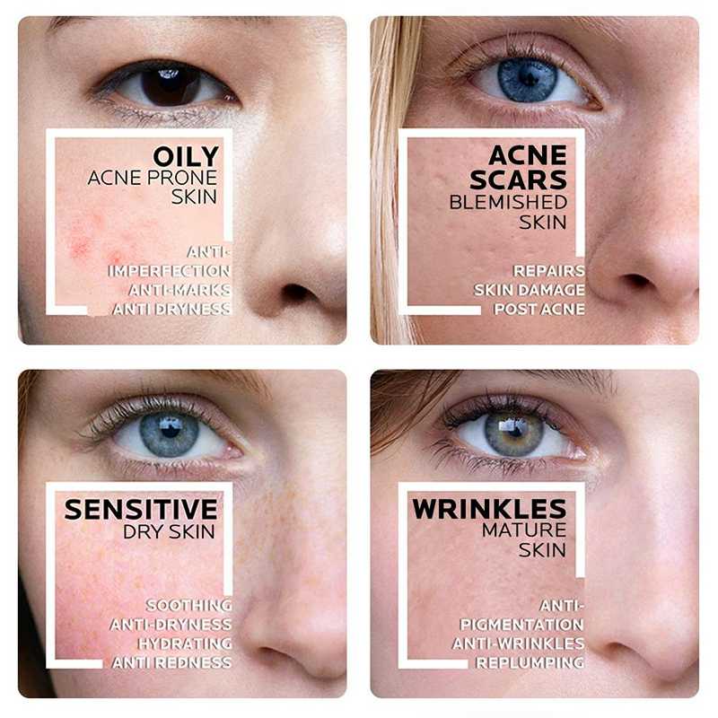 The Ordinary Lactic Acid 10+HA / Lactic Acid 5+HA Pore Minimizer