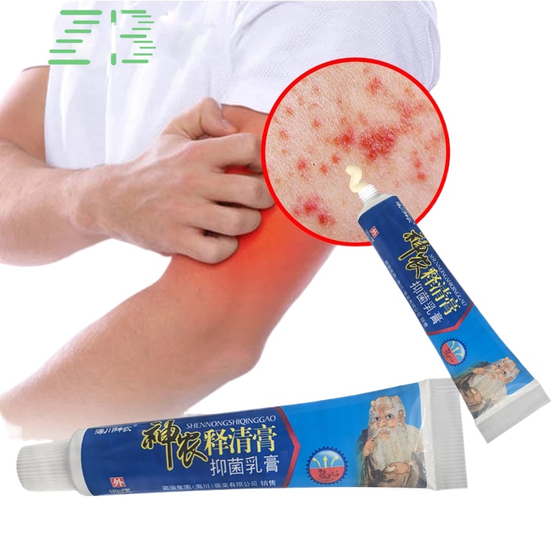 Ointment for psoriasis ZB 2023 Chinese Psoriasis Cream Dermatitis