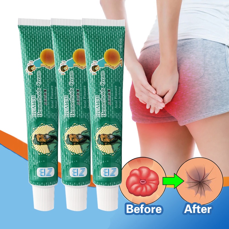 Antiitch ointment Hua Tuo Hemorrhoid Cream Hemorrhoids Treatment